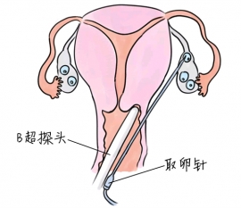 幼儿学画画，西安捐卵宝宝学画画，学画画的好处，如何学画画