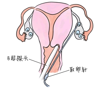 幼儿学画画，西安捐卵宝宝学画画，学画画的好处，如何学画画